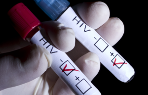 IST’S/HIV/Aids: Fundo Positivo abre edital para seleção de projetos