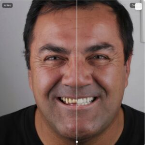 Tecnologia ajuda dentistas a prever resultados estéticos
