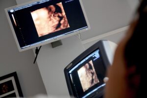 Pesquisa reforça técnica fetal para hérnia diafragmática