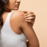 Mês da Dermatite Atópica: os impactos da doença na pele